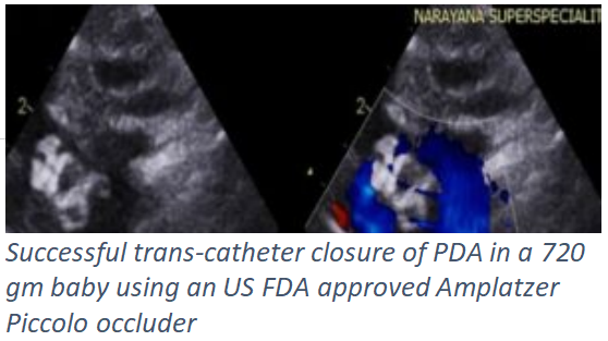The Healers Journal: Preterm PDA: A Tiny Passage with Big Implications for Preemies