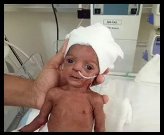 Surgery Image - Shakti (name changed) was only 900gms when he had ...