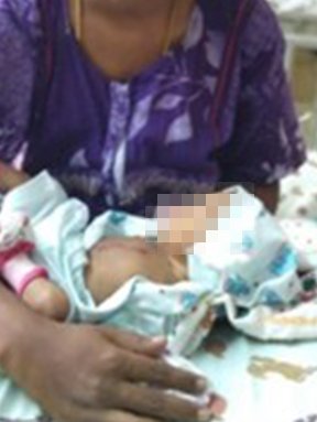 Story of Baby of Priya